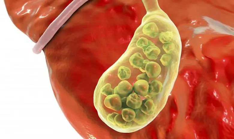  Difference Between Bladder and Gallbladder 