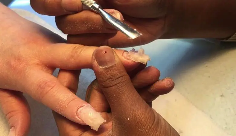  What is the Difference Between EMA and MMA Monomer? 