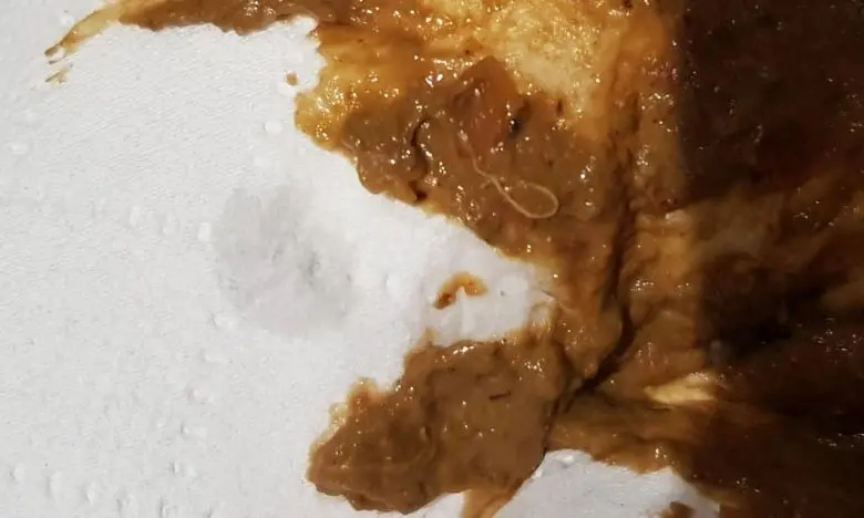  Difference Between Worms and Mucus in Stool? 